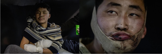 ��, ��ũ���̳� 2�� �ĺ��� ���� ����(����) ��ӿ� ����